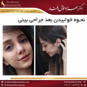 نحوه خوابیدن بعد جراحی بینی دکتر بهزاد خوش رفتار 