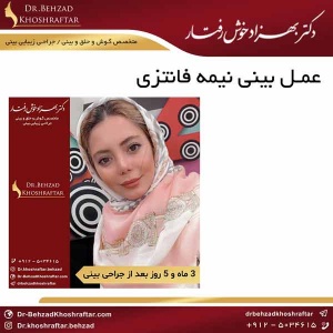 عمل بینی نیمه فانتزی دکتر بهزاد خوش رفتار