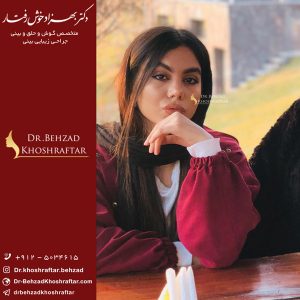 ورزش بعد از جراحی بینی