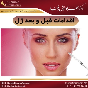 اقدامات قبل و بعد ژل