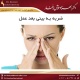 ضربه به بینی بعد عمل دکتر بهزاد خوش رفتار