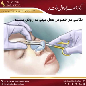نکاتی در خصوص عمل بینی به روش بسته دکتر بهزاد خوش رفتار