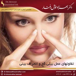 تفاوتهای عمل بینی کج و انحراف بینی دکتر بهزاد خوش رفتار