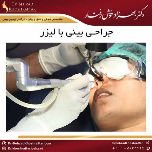 جراحی بینی با لیزر دکتر بهزاد خوش رفتار