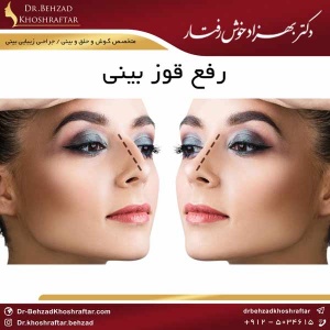 رفع قوز بینی دکتر بهزاد خوش رفتار