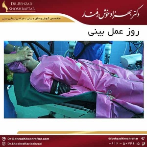 روز عمل بینی دکتر بهزاد خوش رفتار