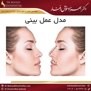 مدل عمل بینی دکتر بهزاد خوش رفتار