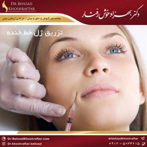 تزریق ژل خط خنده دکتر بهزاد خوش رفتار