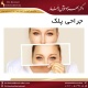 جراحی پلک دکتر بهزاد خوش رفتار