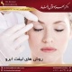 روش های لیفت ابرو دکتر بهزاد خوش رفتار