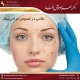 نکاتی در خصوص جراحی پلک دکتر بهزاد خوش رفتار