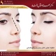 تفاوت میان عمل بینی و رینوپلاستی دکتر بهزاد خوش رفتار
