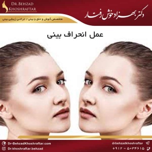 تفاوت میان عمل بینی و رینوپلاستی دکتر بهزاد خوش رفتار