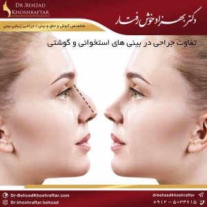 تفاوت جراحی در بینی های استخوانی و گوشتی دکتر بهزاد خوش رفتار