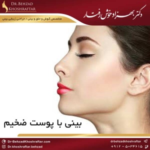 بینی با پوست ضخیم دکتر بهزاد خوش رفتار