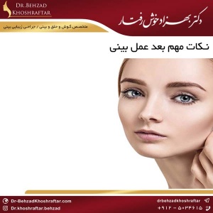 نکات مهم بعد عمل بینی دکتر بهزاد خوش رفتار