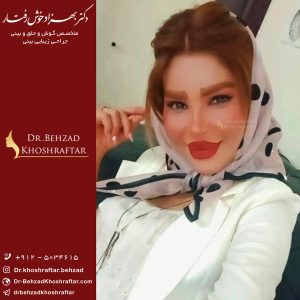 نکات مهم بعد عمل بینی