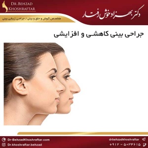 جراحی بینی کاهشی و افزایشی دکتر بهزاد خوش رفتار