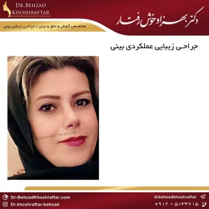 جراحی زیبایی عملکردی بینی دکتر بهزاد خوش رفتار