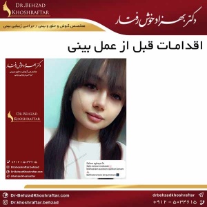 اقدامات قبل از عمل بینی دکتر بهزاد خوش رفتار