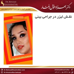 نقش لیزر در جراحی بینی دکتر بهزاد خوش رفتار 