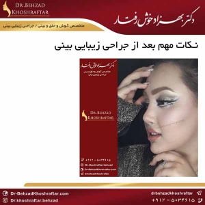 نکات مهم بعد از جراحی زیبایی بینی دکتر بهزاد خوش رفتار 