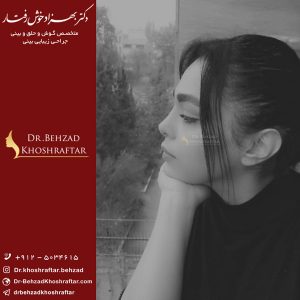 جراحی بینی در تهران