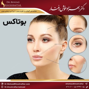 بوتاکس