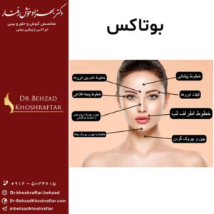 بوتاکس
