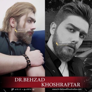 جراحی بینی مردانه