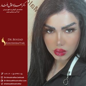 بهترین جراح بینی گوشتی در تهران را بشناسید
