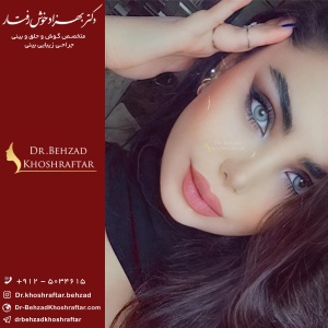 جراحی ترمیم بینی