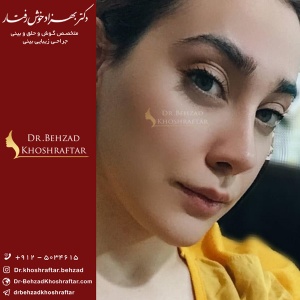 بینی نیمه فانتزی و فانتزی